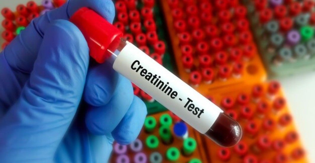 Normal creatinine levels by age key insights for kidney health